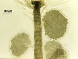 7 – Piastre spermatangiali inserite sulla cellula basale dei tricoblasti